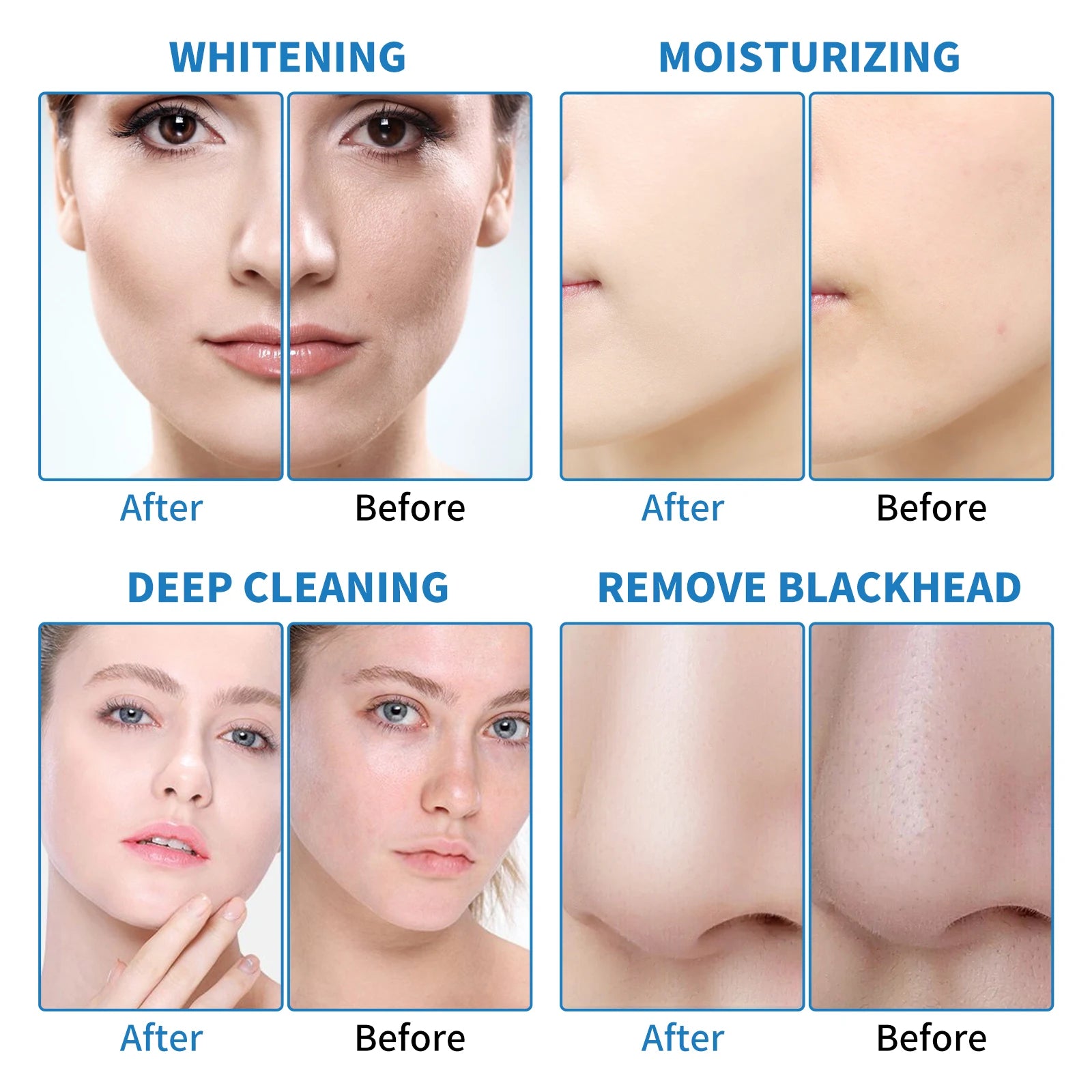 6 in 1 Hydra Blackhead Remover Face Cleaning Brush Massager Facial Machine Skincare Beauty Products for Women